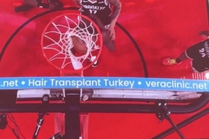 問啥詹姆斯！NBA籃板上沿有土耳其植發(fā)公司廣告 手動@杰倫-布朗