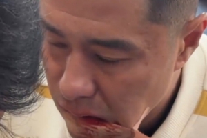 硬漢！國安足協(xié)杯奪冠后，侯森在場邊默默處理嘴部傷口